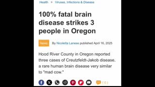 Zombie Apocalypse Warning? CJD Cases in Oregon Raise New Questions About CWD and Prion Disease